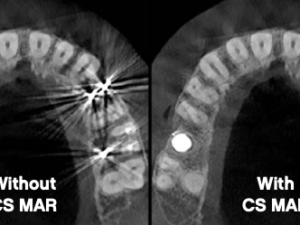 Software CS8200 3d Carestream