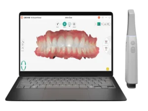 Scanner intraorale Dexis imprevo con PC