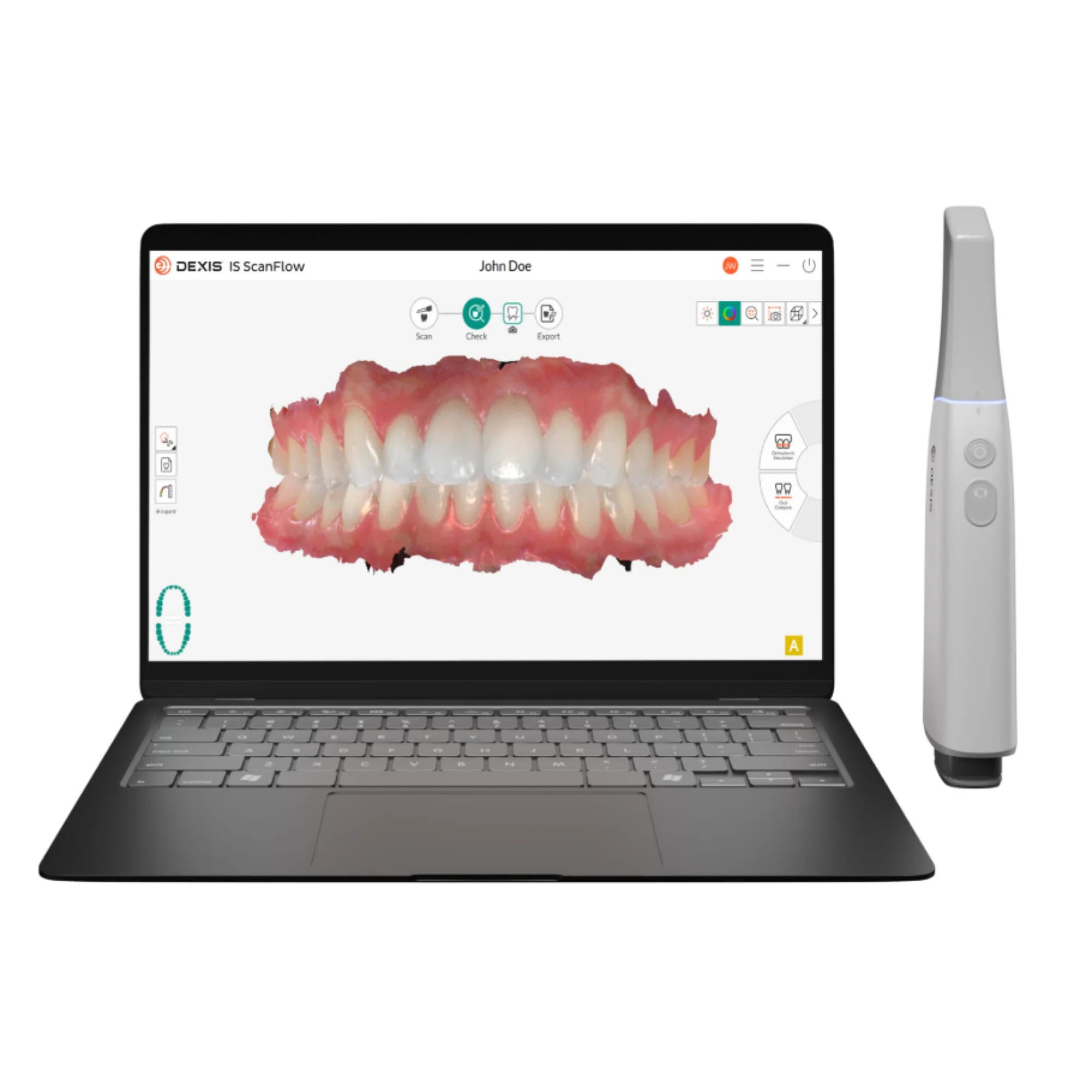 Scanner intraorale Dexis imprevo con PC