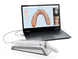 Scanner intraorale iTero elements 5D con pc