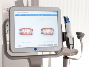Scanner Intraorali Element iTero